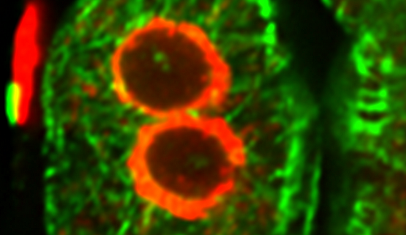 Cell division in Plants: How cell walls are assembled
