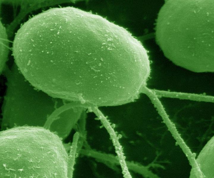 Chlamydomonas reinhardtii