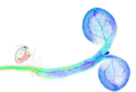 Watching changes in plant metabolism – live