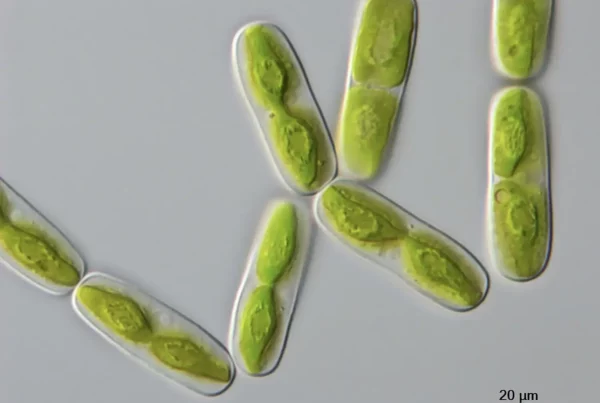 Microscope image of one of the closest algal relatives of land plants, a single-celled alga called Mesotaenium endlicherianum (20 micrometres corresponds to 0.02 millimetres). Credit: Tatyana Darienko