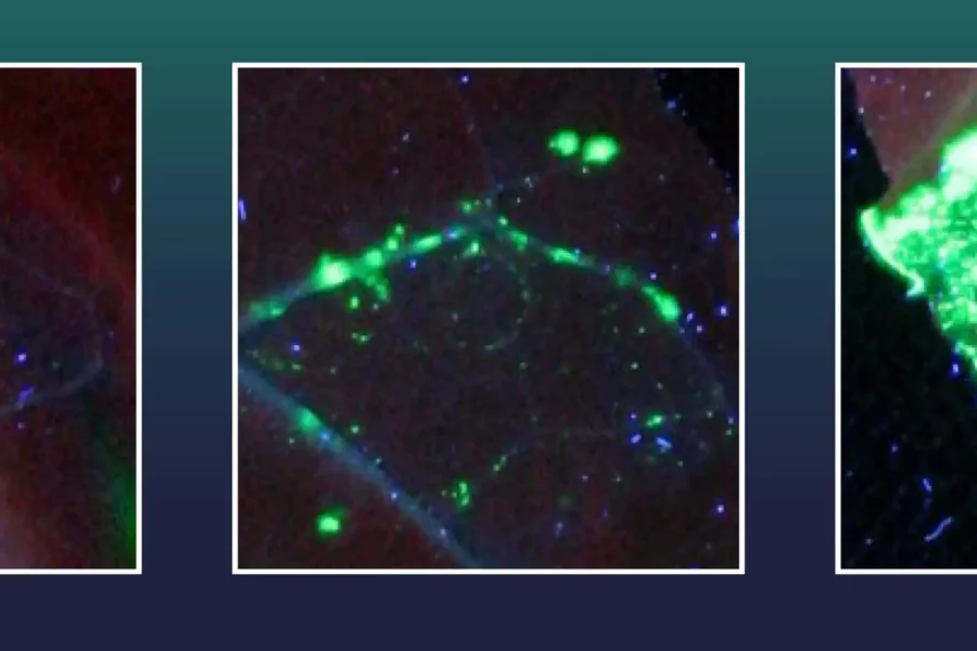 Each green fluorescent spot represents a leaf cell in which a large gene segment was successfully inserted into the plant's genome. Different variants of Cas9 were used: an inactiv Cas9 (left), an active Cas9 (center) and Cas9 fused with an exonuclease (right) Credit: Tom Schreiber, IPB, Leibniz Institute of Plant Biochemistry, IPB