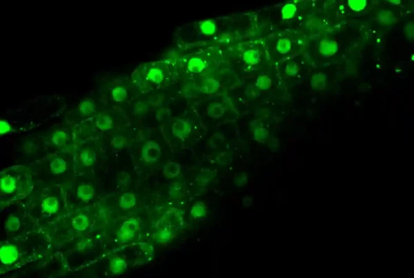Image: Confocal microscopy of Arabidopsis plants expressing NAC53 fused to GFP. Credit: Suayb Üstün